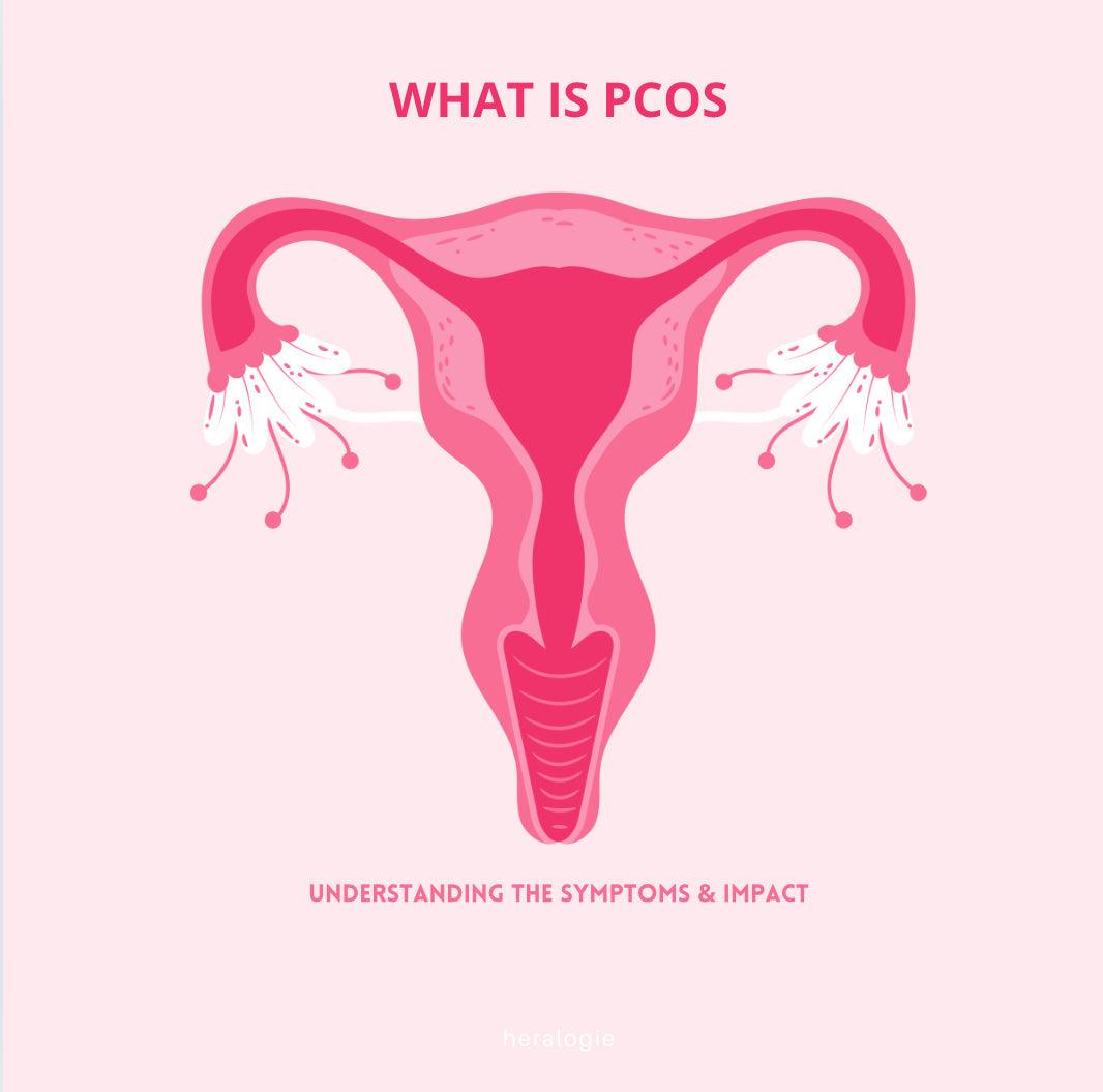 PCOS awareness illustration showing female reproductive system on pink background