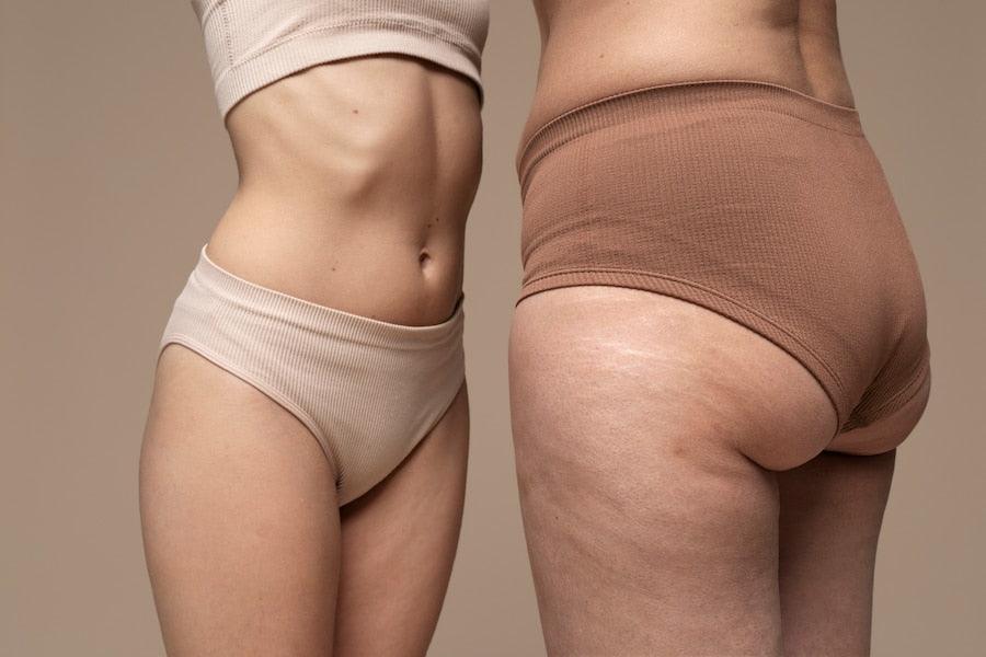 Women Standing Together Wearing Period Undergarments